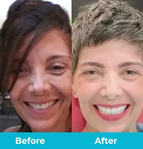 Before & After